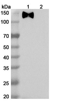 HCMV/HHV5 gB Neutralizing Human Monoclonal Antibody