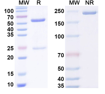 CBX2 Mouse Monoclonal Antibody