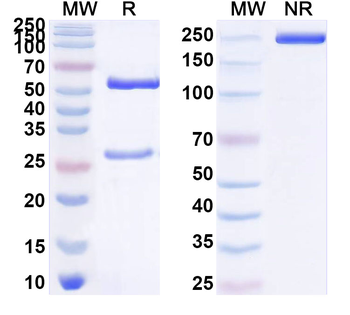 Helicobacter pylori ureB/Urease subunit beta Mouse Monoclonal Antibody