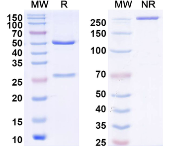 DENV-1/2/3/4 Envelope protein E/EDIII A strand Human Monoclonal Antibody