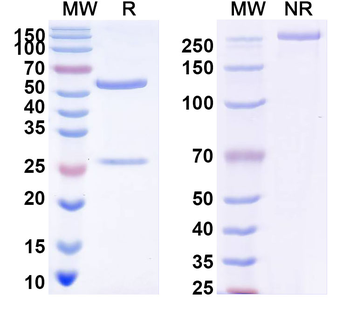 DENV-4 Envelope protein E/EDI domain Human Monoclonal Antibody
