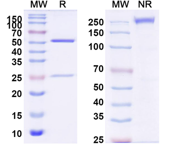DENV-2 Envelope protein E/EDIII domain Human Monoclonal Antibody