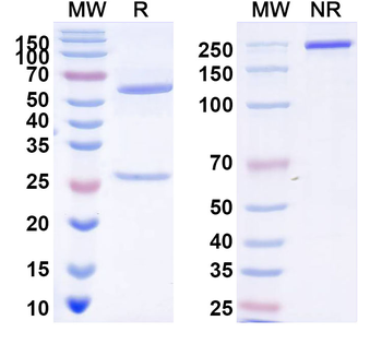 Nipah virus/NiV Fusion glycoprotein F2 Human Monoclonal Antibody