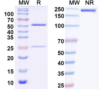 Clostridium perfringens pfo/Perfringolysin O/Theta-toxin Mouse Monoclonal Antibody