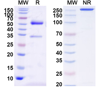 Clostridium perfringens pfo/Perfringolysin O/Theta-toxin Mouse Monoclonal Antibody