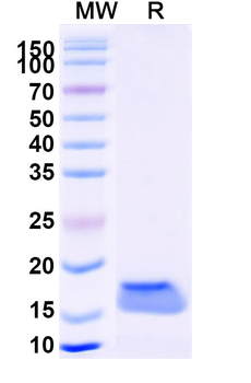 Sahara scorpion AaH II/Neurotoxin II Camelus Monoclonal Antibody