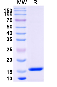Sahara scorpion AaH II/Neurotoxin II Camelus Monoclonal Antibody