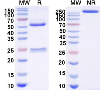 Nipah virus/NiV Fusion glycoprotein/F Trimer Human Monoclonal Antibody