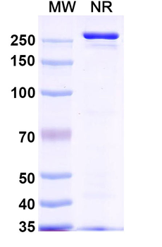 Nipah virus/NiV Prefusion Protein Human Monoclonal Antibody