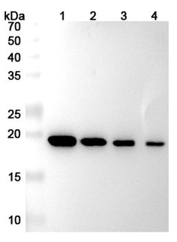MMP7 Mouse Monoclonal Antibody