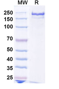 ATTR/Transthyretin amyloidosis Mouse Monoclonal Antibody