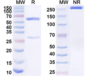 pTDP43(Ser403/Ser404) Mouse Monoclonal Antibody