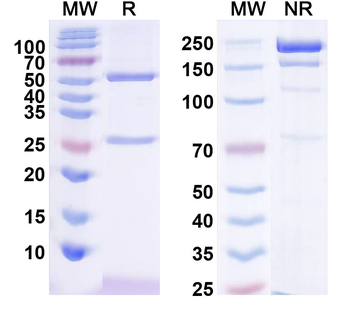 IRSp53/BAIAP2 Mouse Monoclonal Antibody