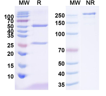 IRSp53/BAIAP2 Mouse Monoclonal Antibody