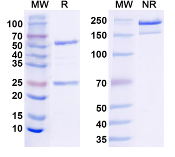 Bassoon Mouse Monoclonal Antibody