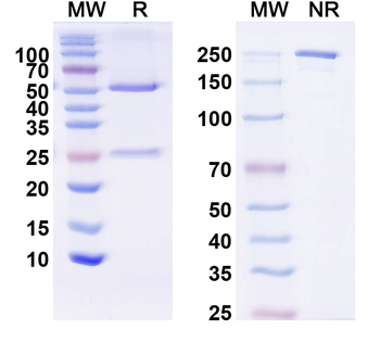 KChIP1 K+ channel Mouse Monoclonal Antibody