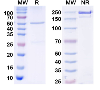 NGL-3/LRRC4B Mouse Monoclonal Antibody