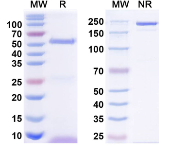 GABA(A)R, Beta1 Mouse Monoclonal Antibody