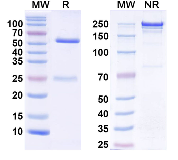 NGL-1/LRRC4C Mouse Monoclonal Antibody