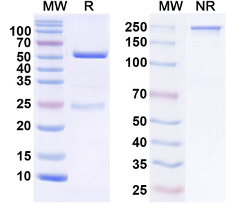 NGL-2/LRRC4 Mouse Monoclonal Antibody