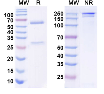 WNK3 Mouse Monoclonal Antibody