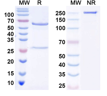 OCRL/INPP5b Mouse Monoclonal Antibody