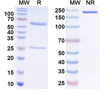 ASIC2A Mouse Monoclonal Antibody
