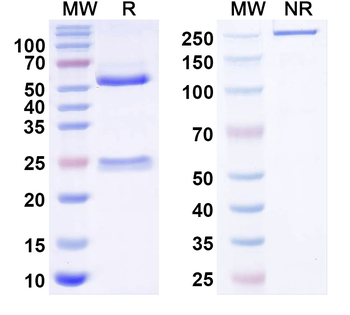 ASIC2A Mouse Monoclonal Antibody