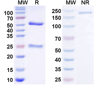 GluN2C/NR2C glutamate receptor Mouse Monoclonal Antibody