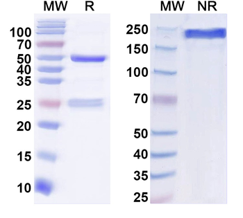 GluN2B/NR2B glutamate receptor Mouse Monoclonal Antibody