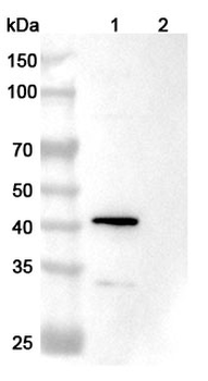 GluN2B/NR2B glutamate receptor Mouse Monoclonal Antibody
