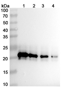 IL6 Human Monoclonal Antibody