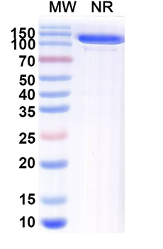Bacillus cereus blm/Metallo-beta-lactamase type 2 Human Monoclonal Antibody