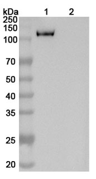 ROBO1 Human Monoclonal Antibody