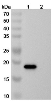 Rotavirus A VP4/Outer capsid protein VP4 Human Monoclonal Antibody