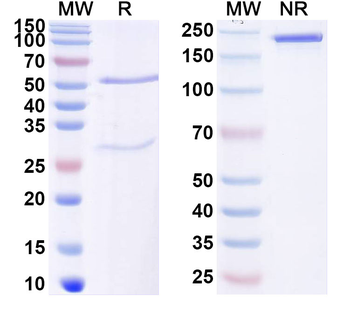 MATN3/Matrilin-3 Mouse Monoclonal Antibody