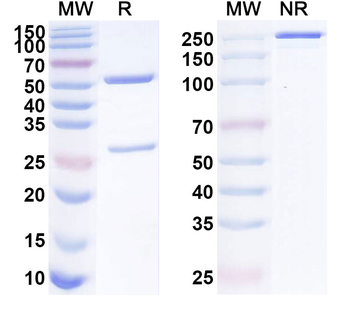 TRPV2 Mouse Monoclonal Antibody