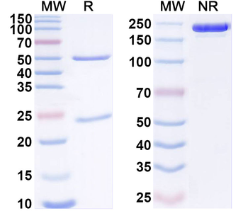 FZD8 Mouse Monoclonal Antibody