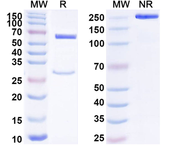 CD201/PROCR/EPCR Mouse Monoclonal Antibody