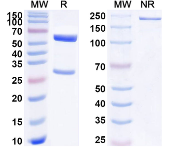 PSEN1/Presenilin-1 Mouse Monoclonal Antibody