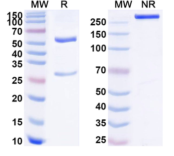 GNRHR/GnRH receptor Mouse Monoclonal Antibody