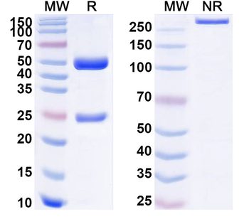CTSD/Cathepsin D Mouse Monoclonal Antibody
