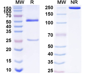AQP4/Aquaporin-4 Mouse Monoclonal Antibody