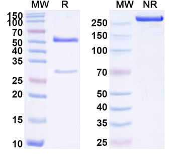 SPINK1 Mouse Monoclonal Antibody