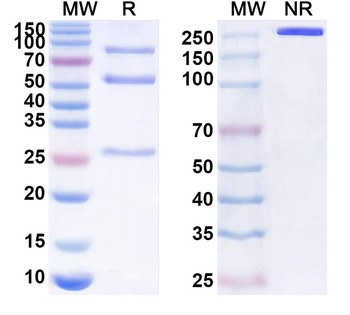 SLC6A6 Mouse Monoclonal Antibody