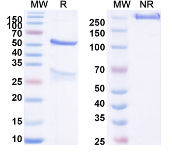CLDN3 Mouse Monoclonal Antibody
