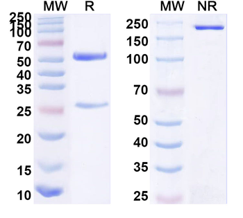 CD340/ERBB2/HER2/NEU Mouse Monoclonal Antibody