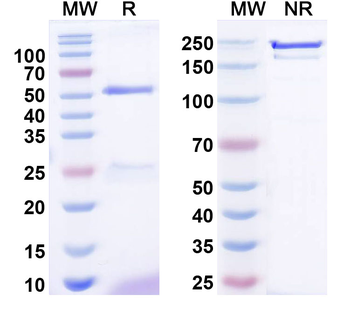 SOST Human Monoclonal Antibody