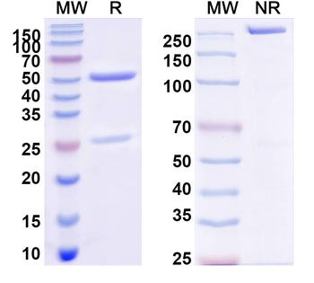 HCMV/HHV5 gH/UL75 Human Monoclonal Antibody
