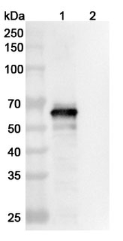 SARS-CoV-2 S2 Protein Human Monoclonal Antibody